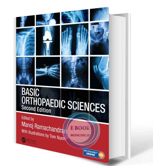 دانلود کتابBasic Orthopaedic Sciences2nd Edition 2017( PDF)